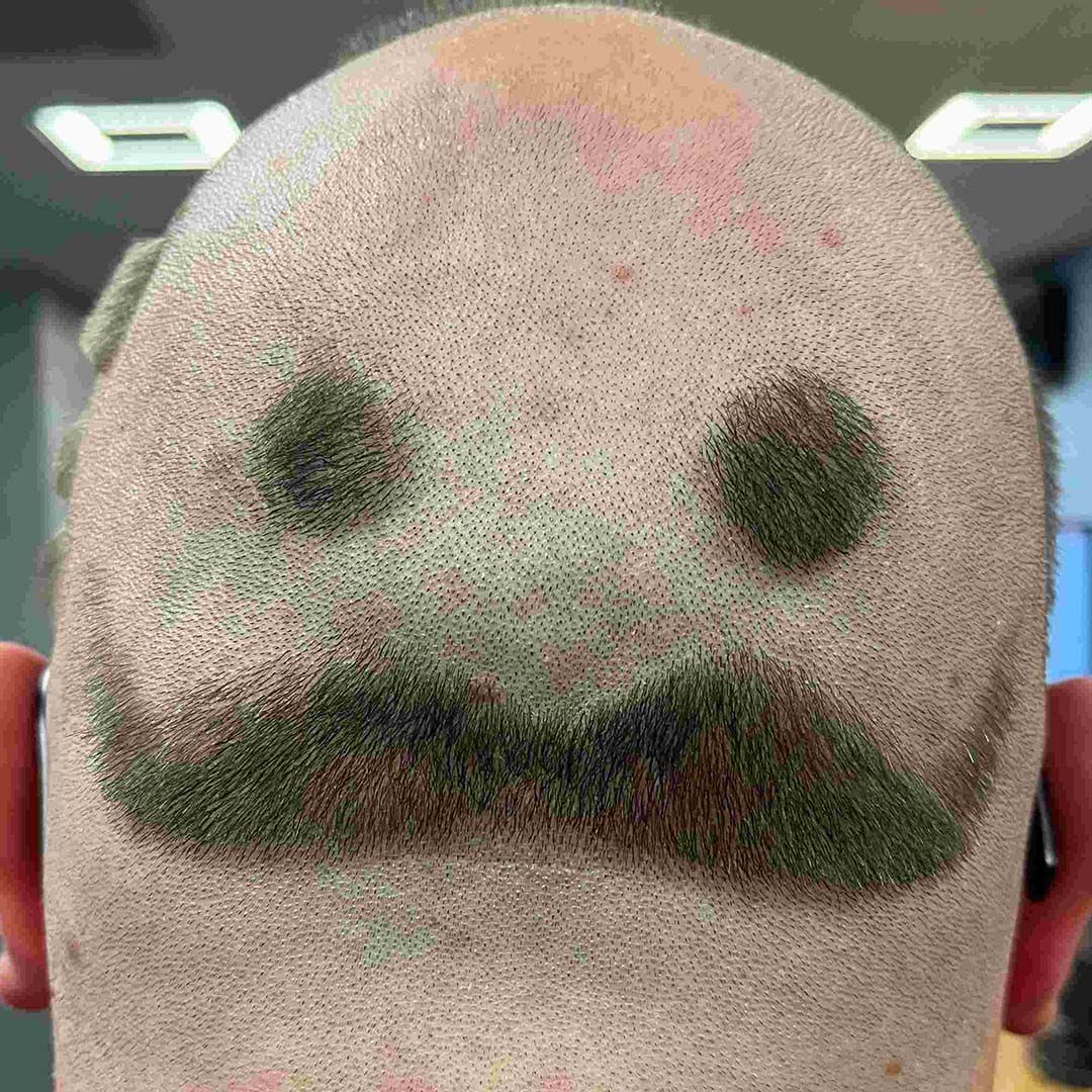 Photo of the back of a man's head, showing a moustache shaved into his head.